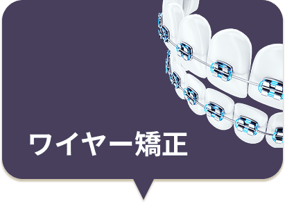 ワイヤー矯正